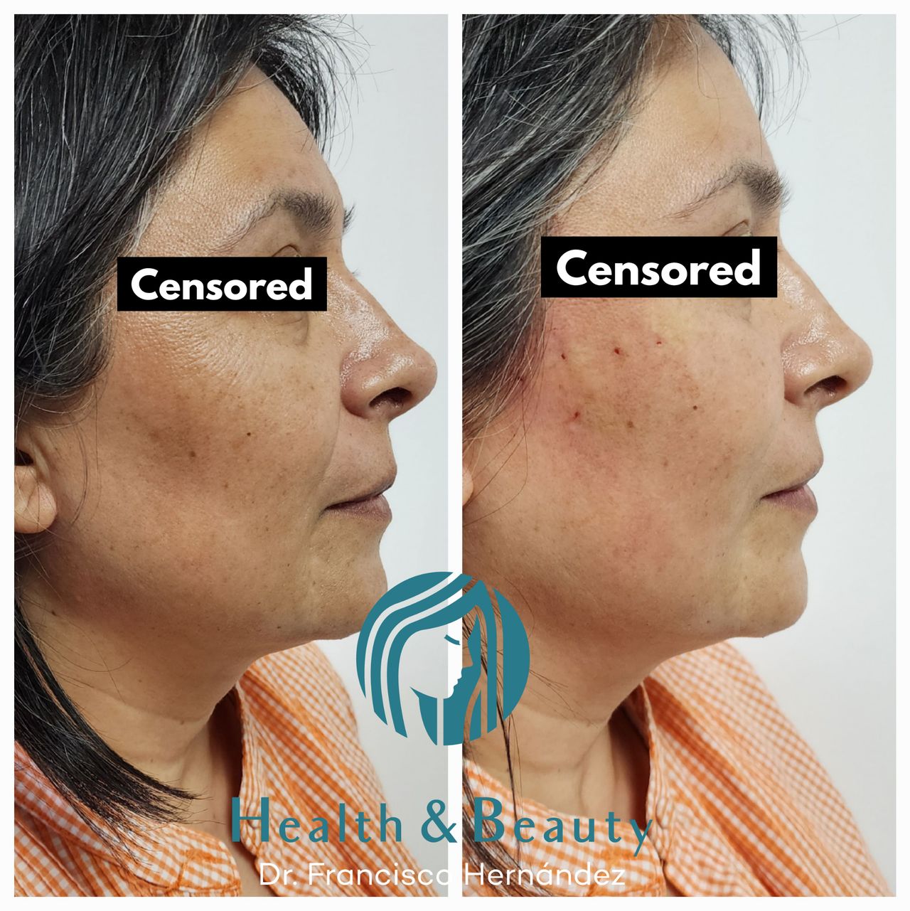 Francisco Hernández Gómez Crespo-64