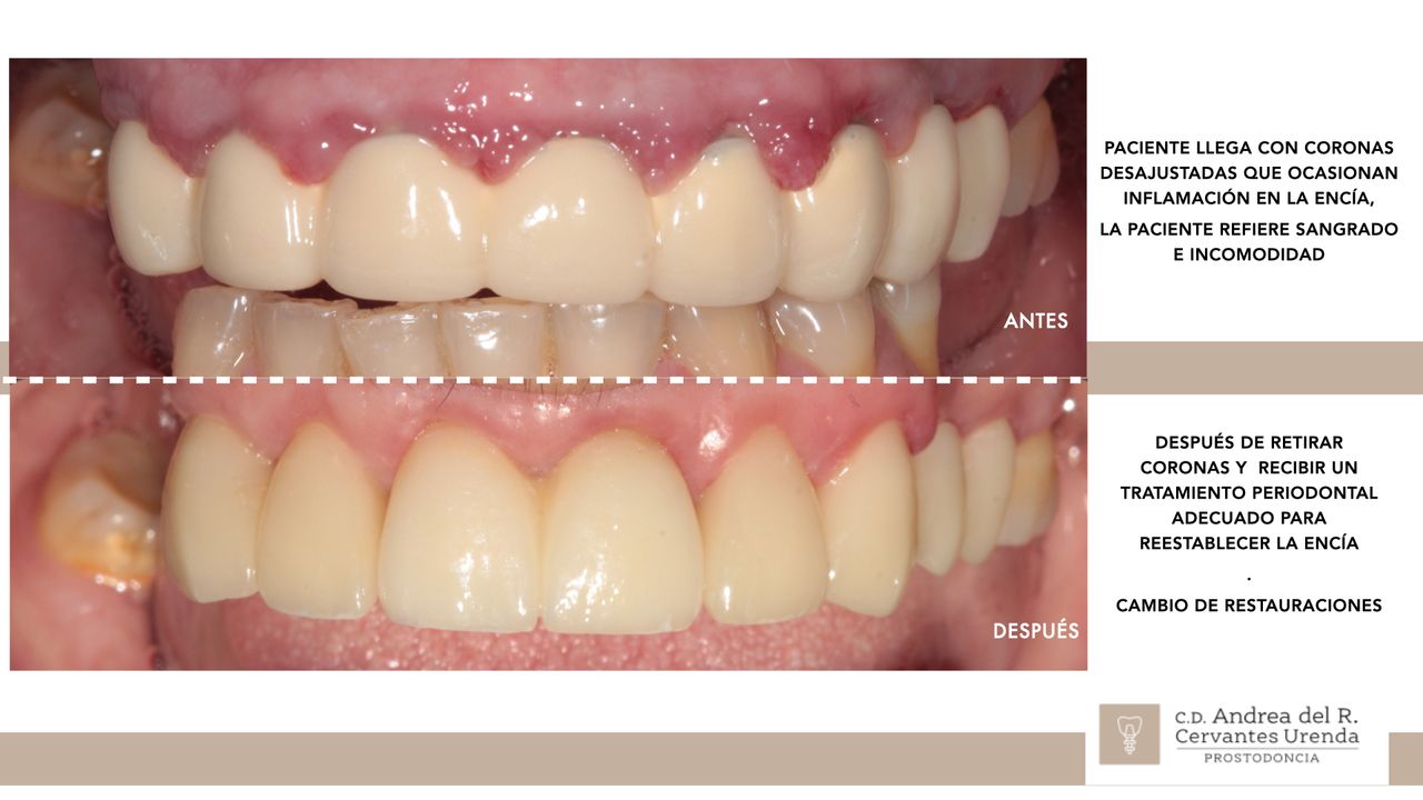 Andrea Cervantes Urenda-31
