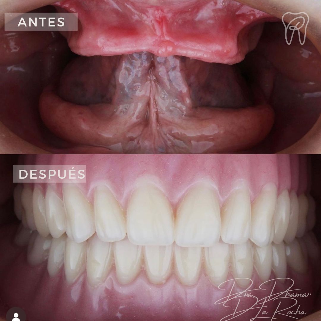 Dhamar De La Rocha Almazan-4