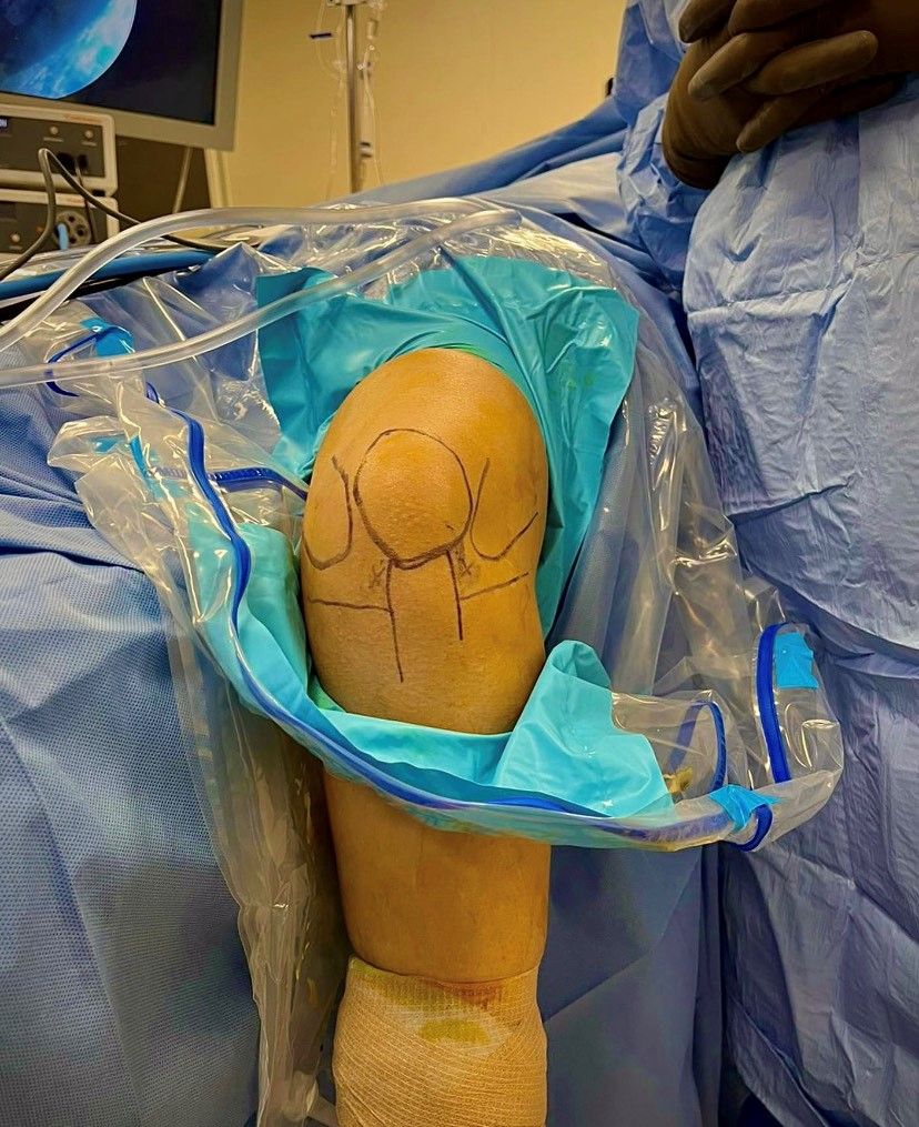 César Alejandro Moreno Palapa-10