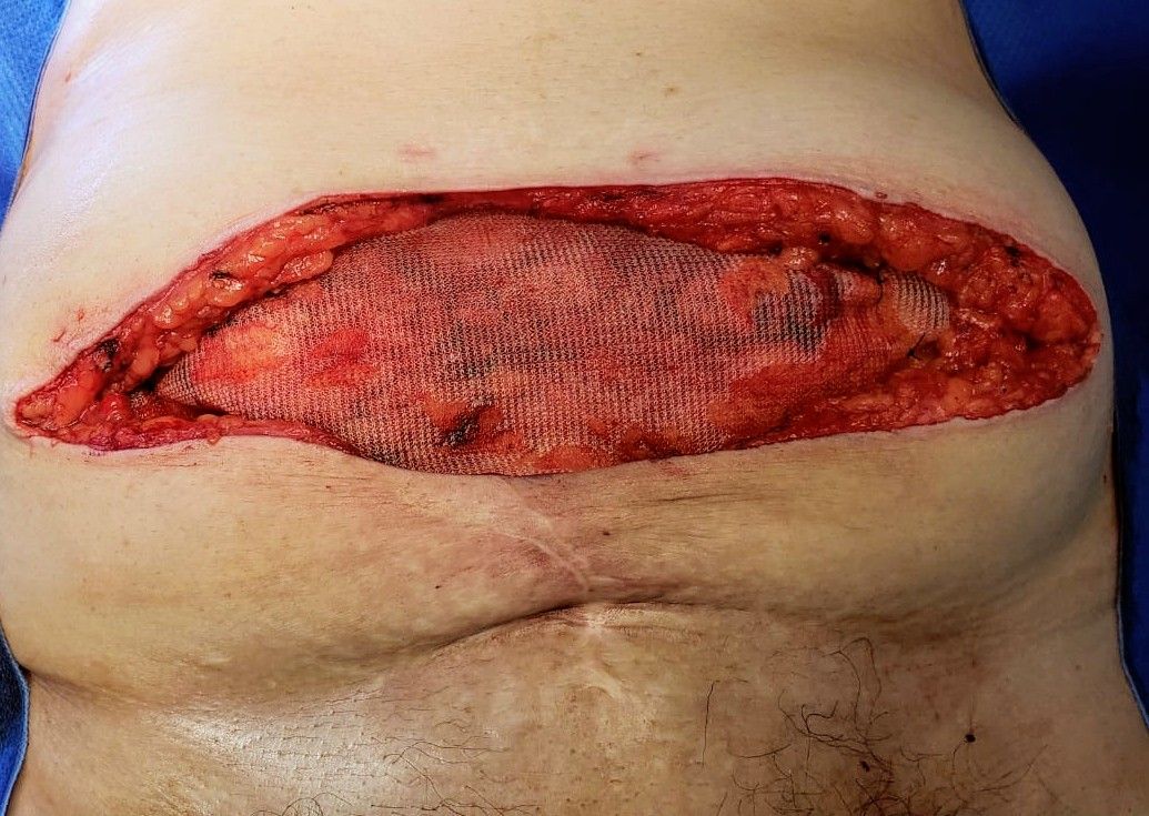 Luis Angel Medina Andrade-18