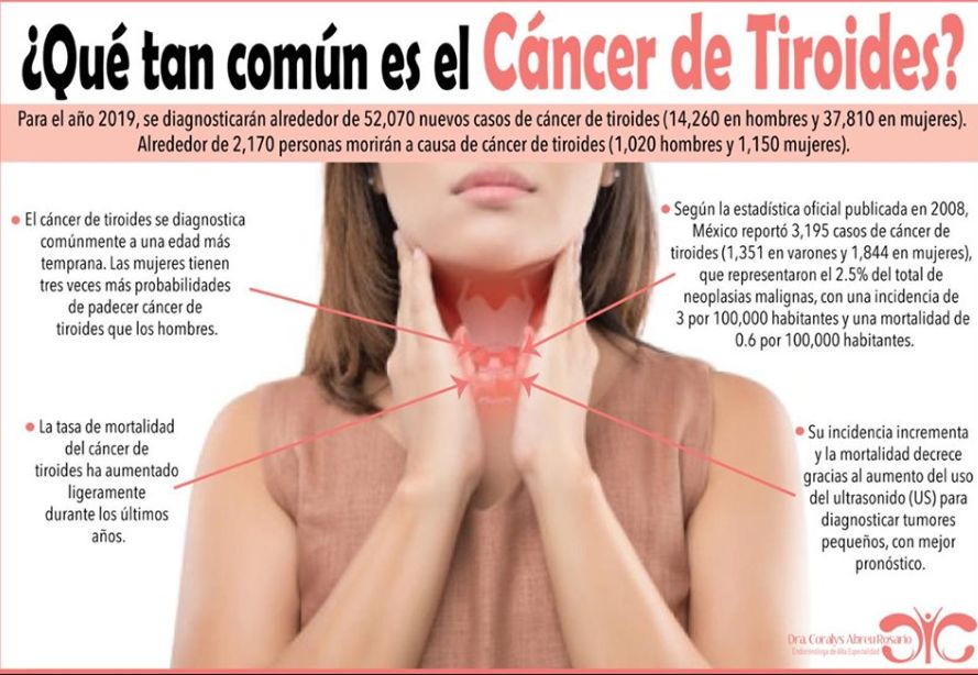 Coralys Abreu Rosario-4