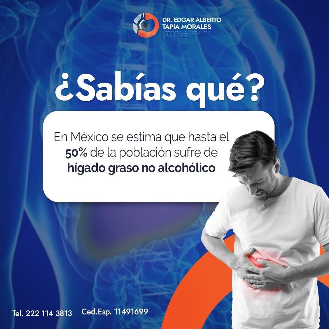 Edgar Alberto Tapia Morales-19