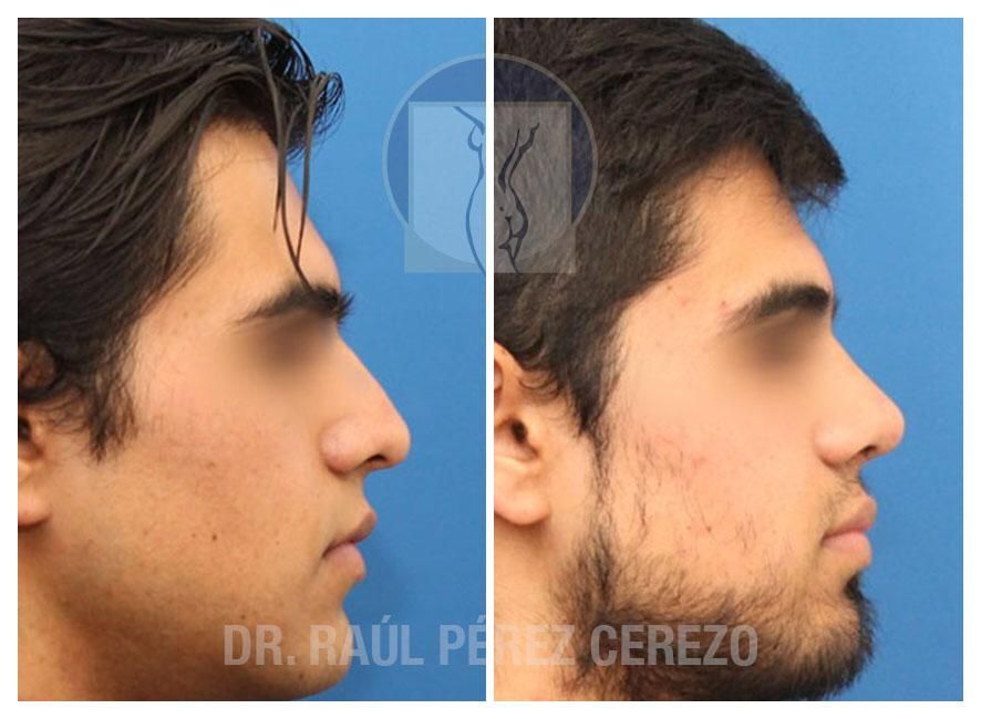 Raúl Pérez Cerezo-20