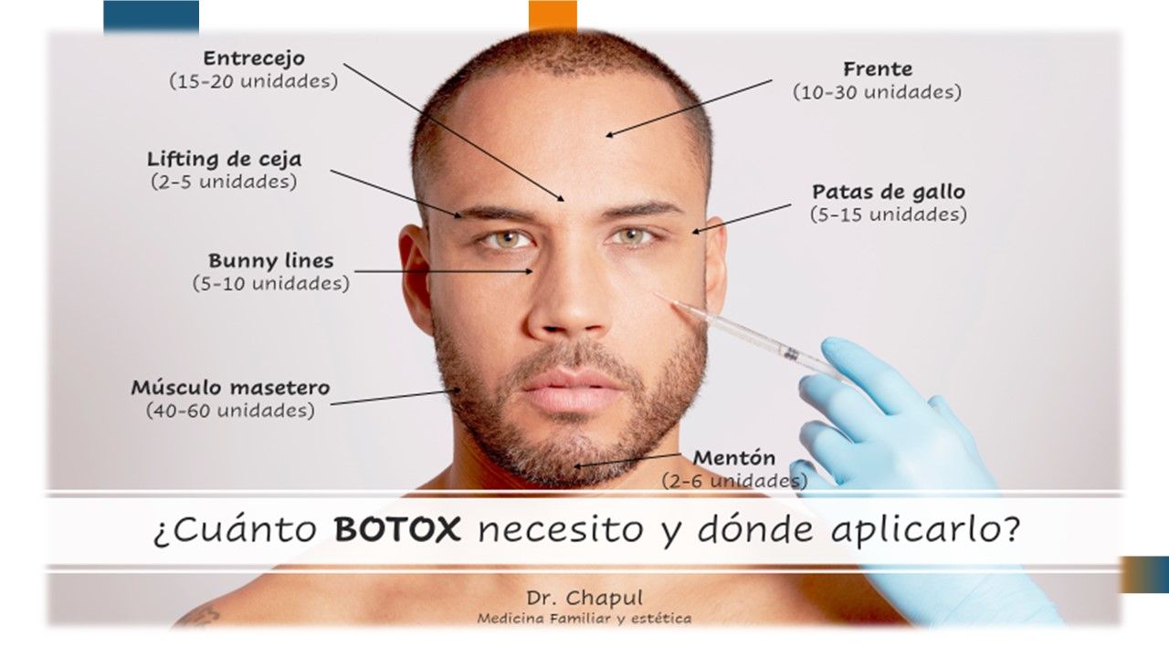 José Luis Muñoz Chapul-19