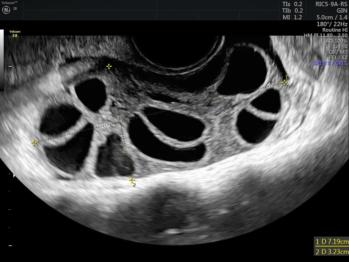 Griselda Reyes Torres-88