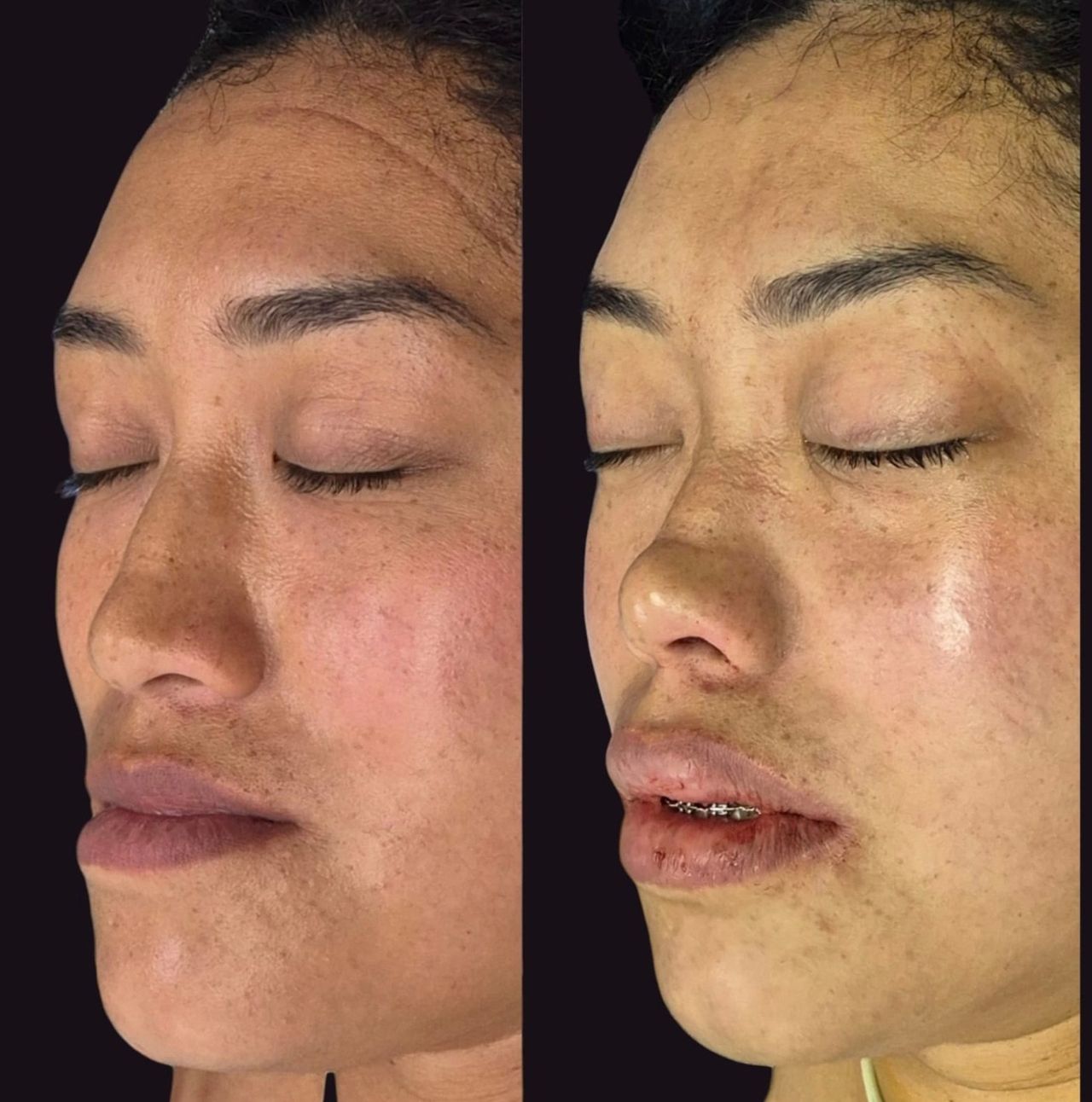 Kevin Matheus Flores Moraz-1