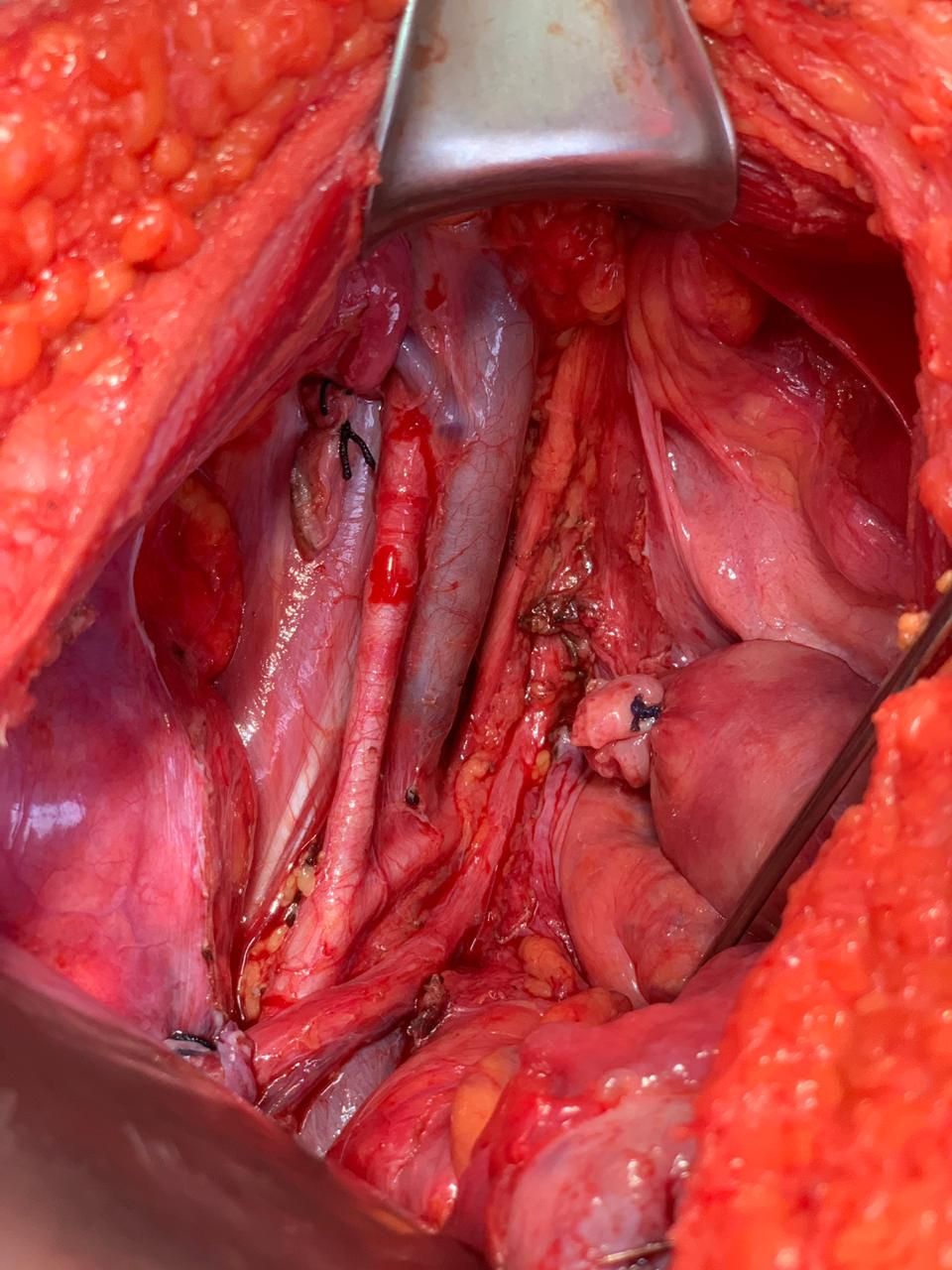 César Espejel Valdés-35