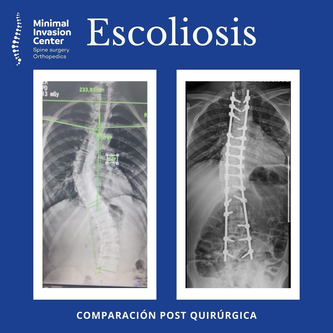 Omar Marroquín Herrera-5