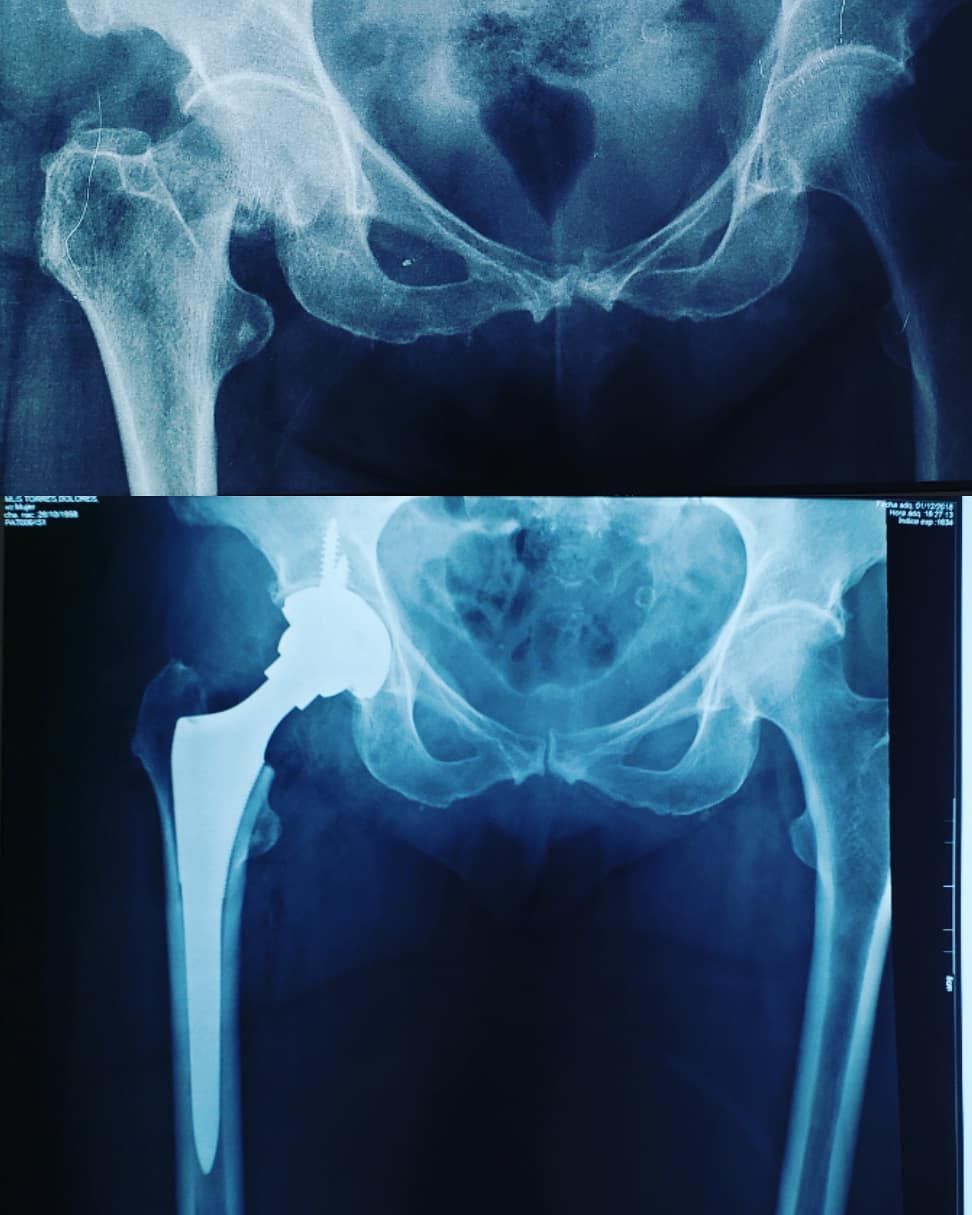 Víctor Hugo Campos Vivas-0