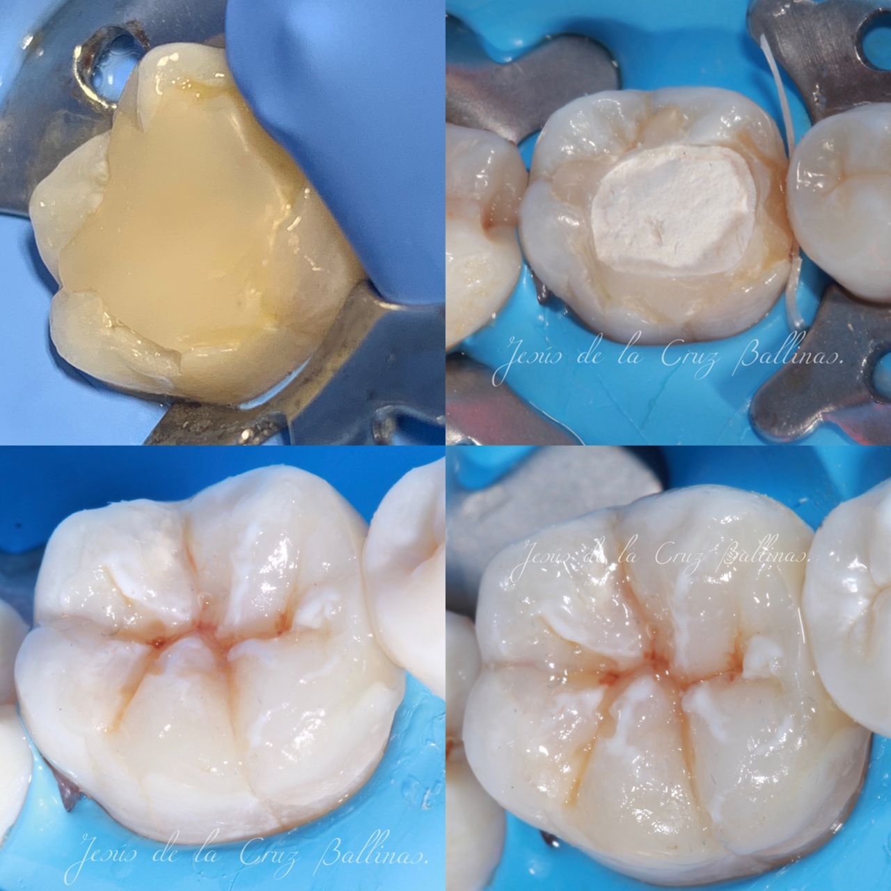 Jesus De La Cruz Ballinas-11