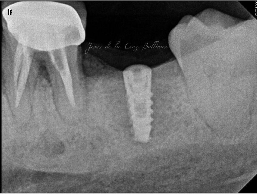 Jesus De La Cruz Ballinas-16