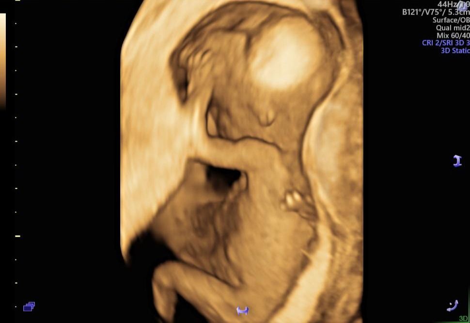 Dulce Anabel Jarquin Arango-34