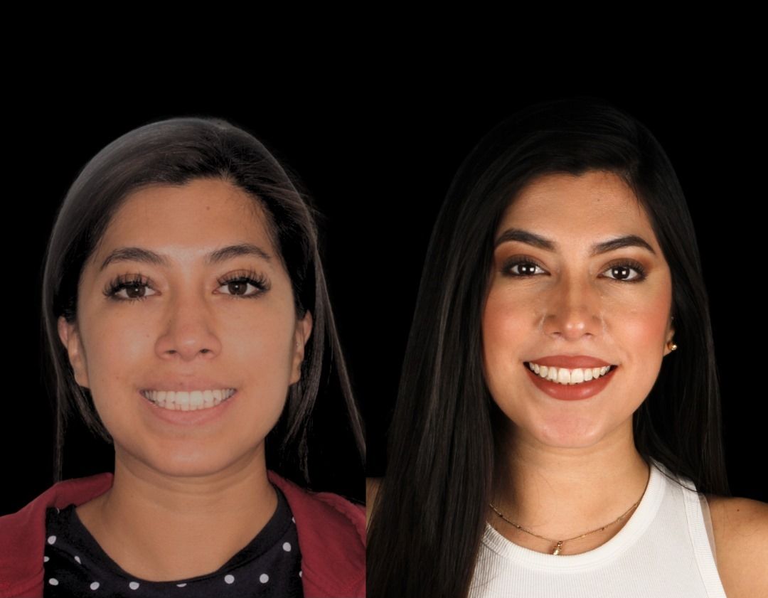 Brenda Osnaya-42