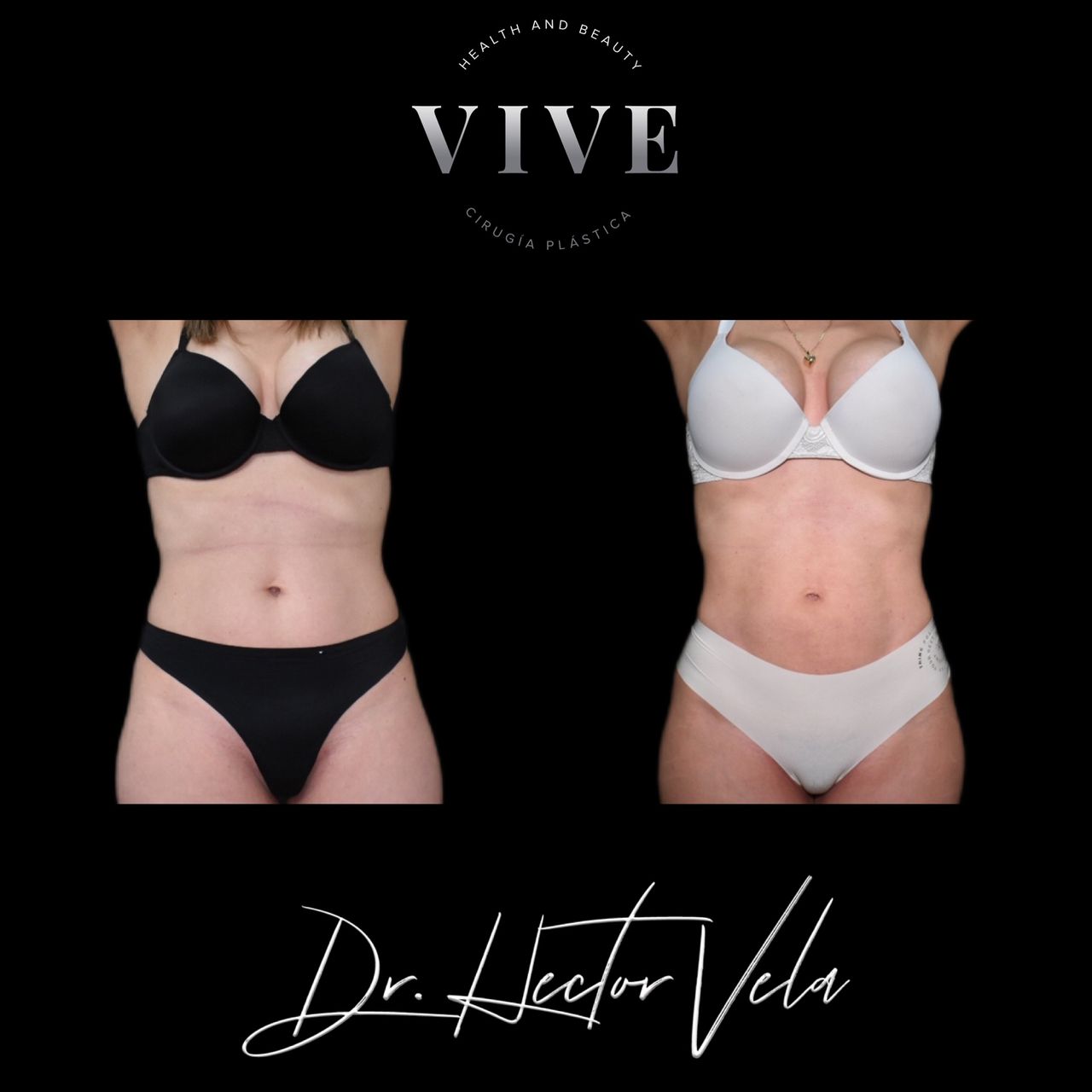 Héctor Eduardo Vela Cardona-100