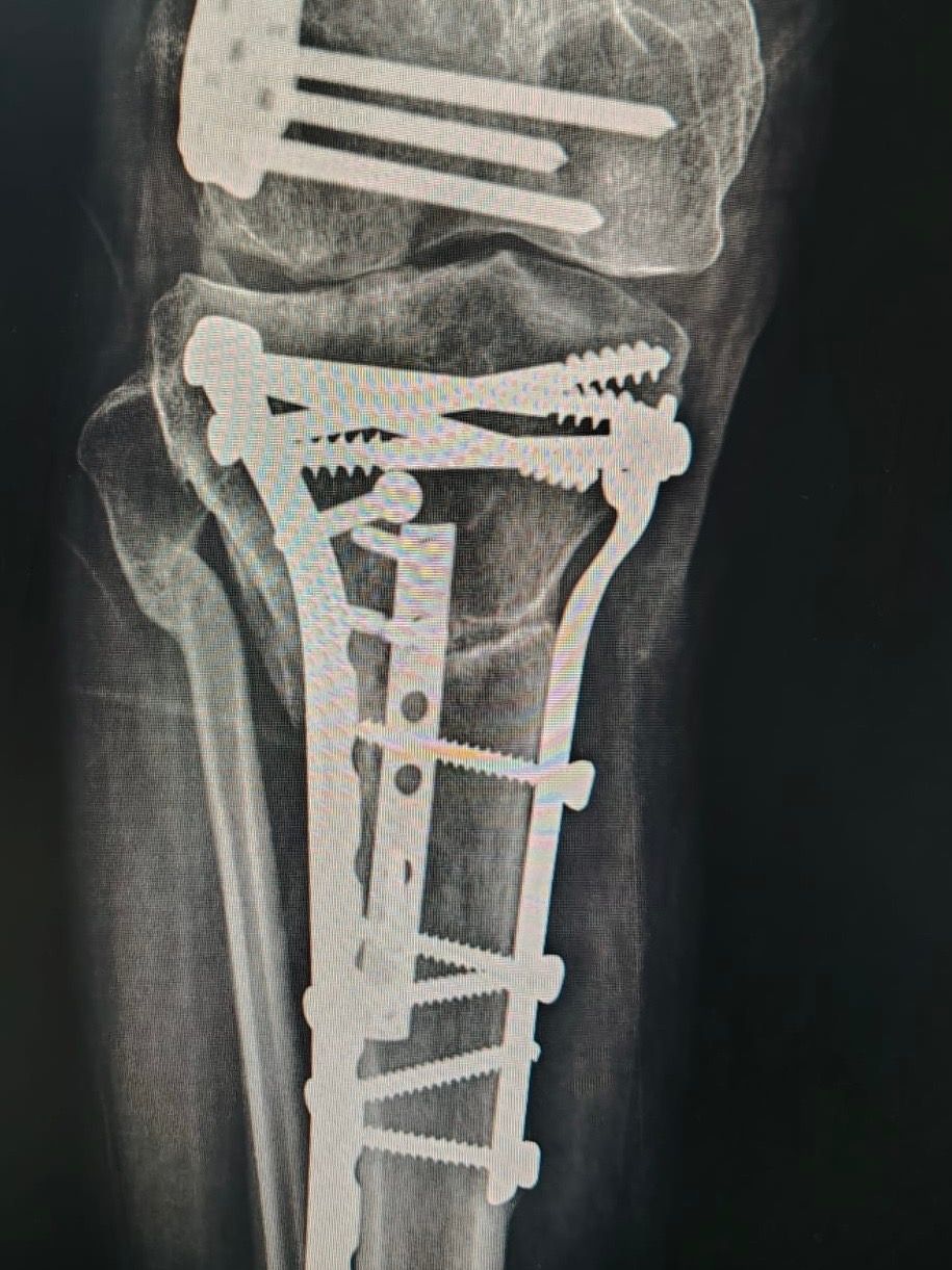 Irving Denilson Peña González-24