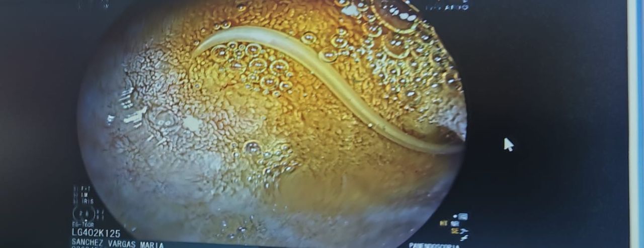 Deneb Pérez Morales-4