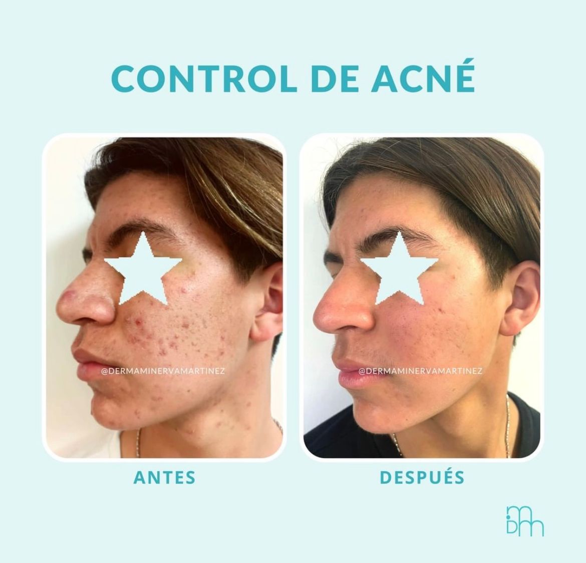 Yadira Minerva Martínez Ortiz-5