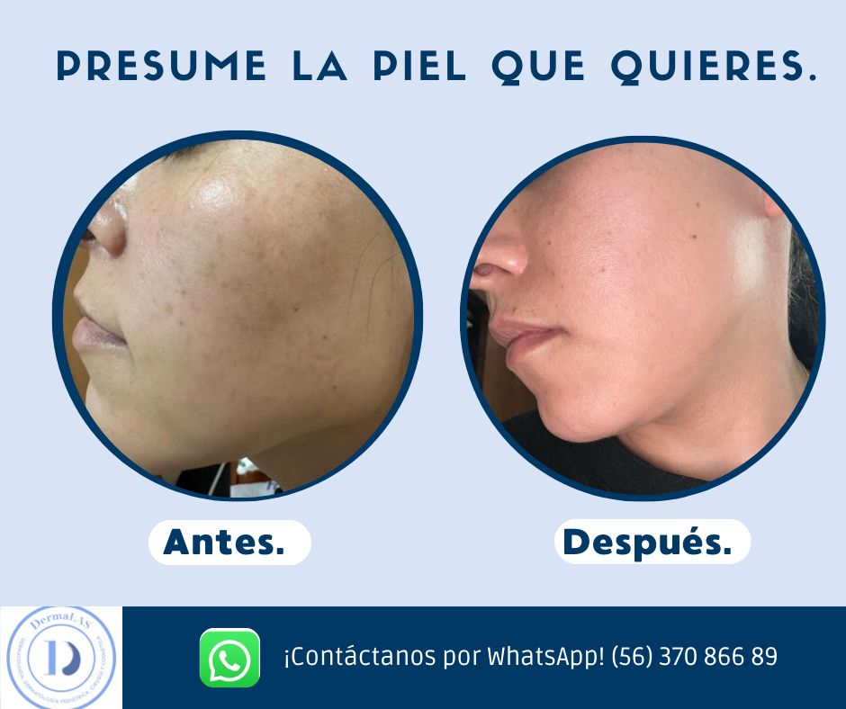 Lorena Aguilar Salas-3