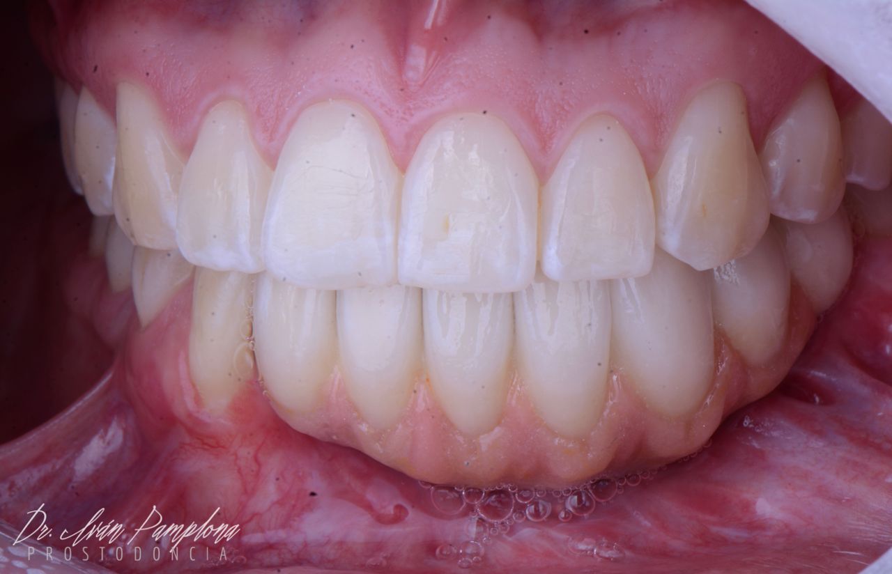 Iván Gerardo Pamplona Alfaro-26