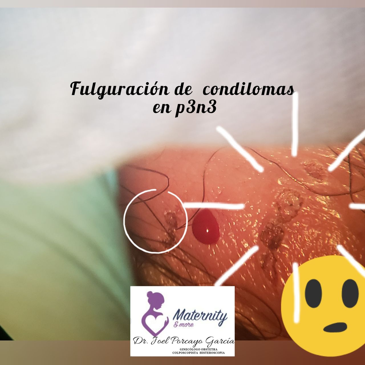 Joel Porcayo Garcia-10