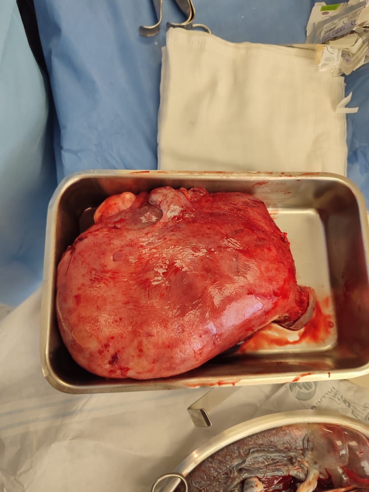 Gonzalo Hernández Martínez-38