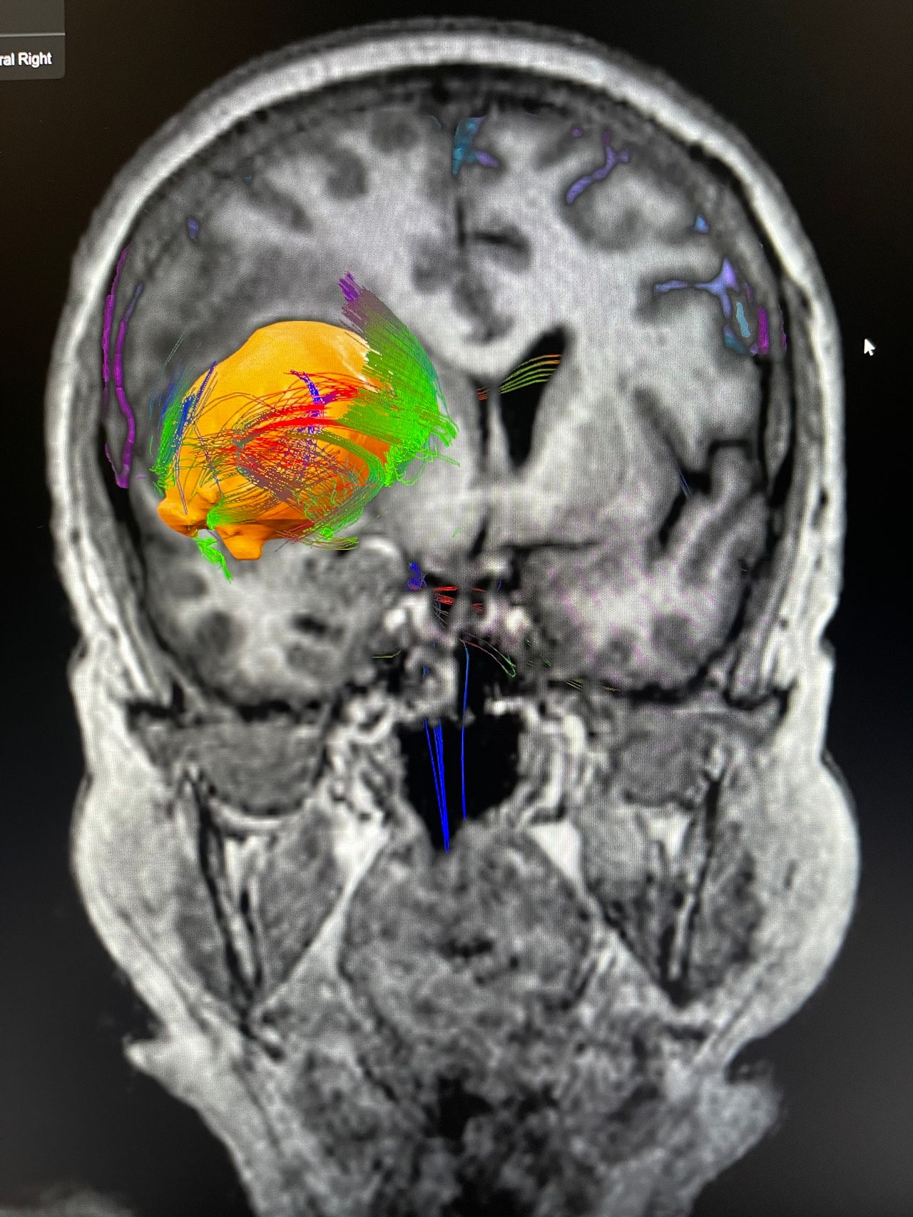 Juan Antonio Alvaro Heredia-2