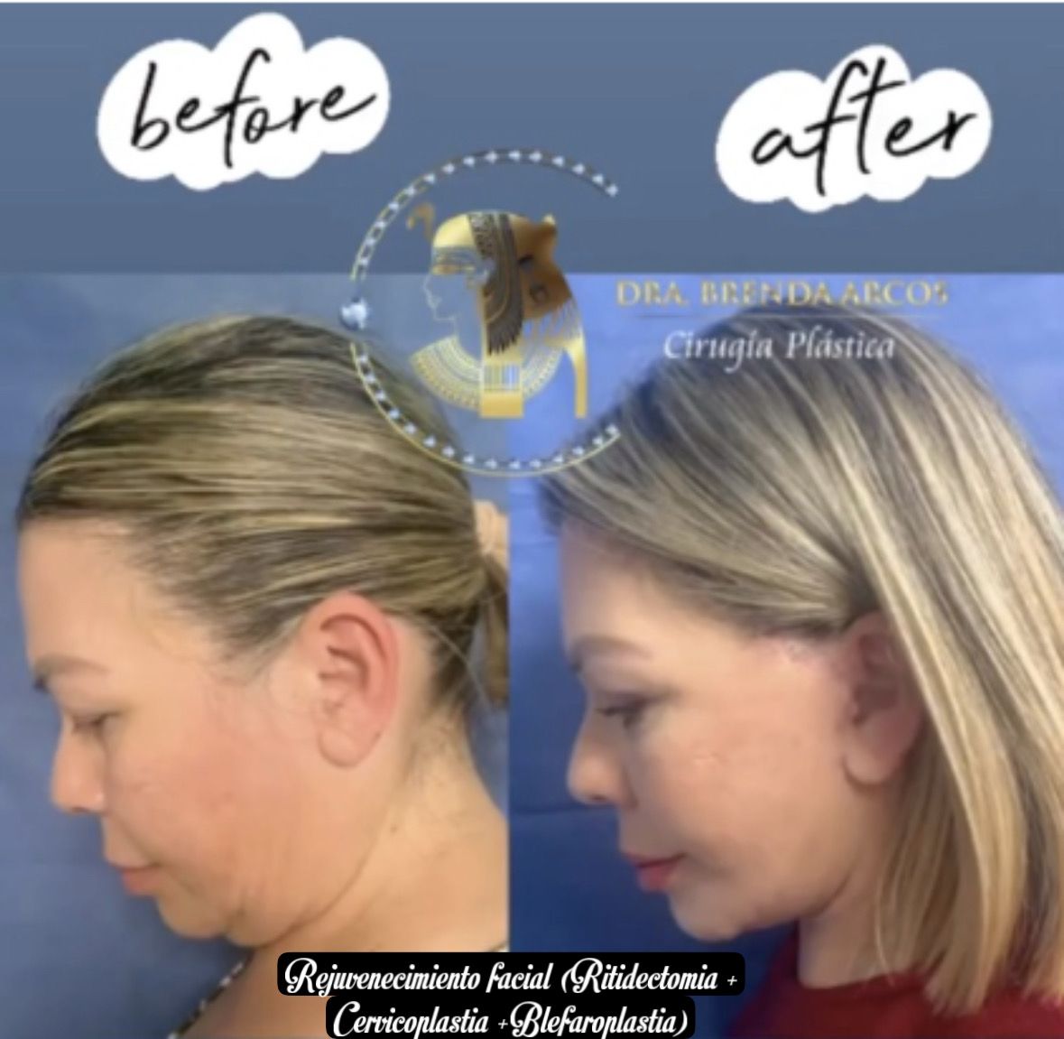 Brenda Arcos Vera-32