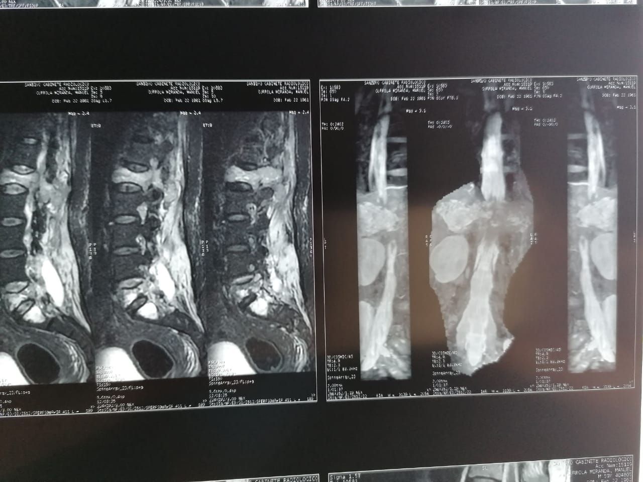 Juan José Luévano De La Cruz-50