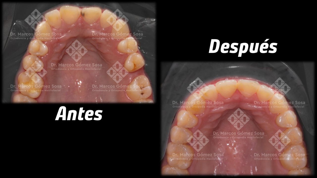 Marcos Gómez Sosa-12