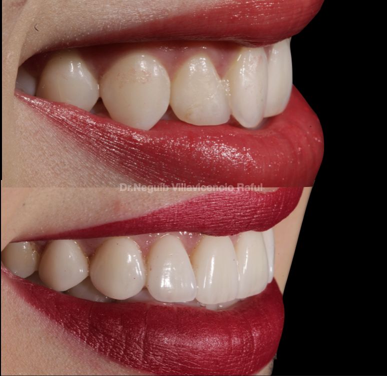 Neguib Villavicencio Raful-38