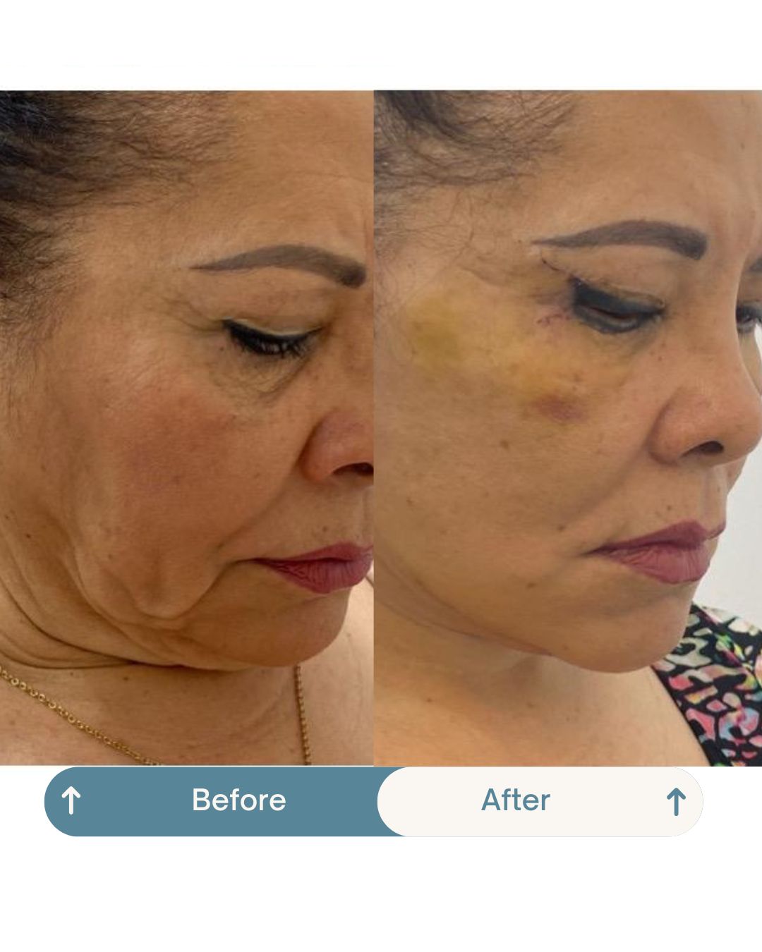 Nashielli Torres Espinosa Chiu-17