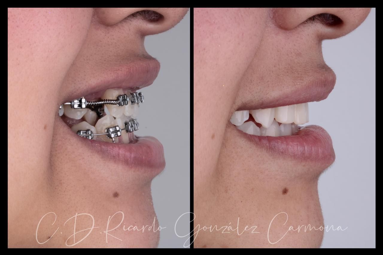 Alicia Carmona López-5