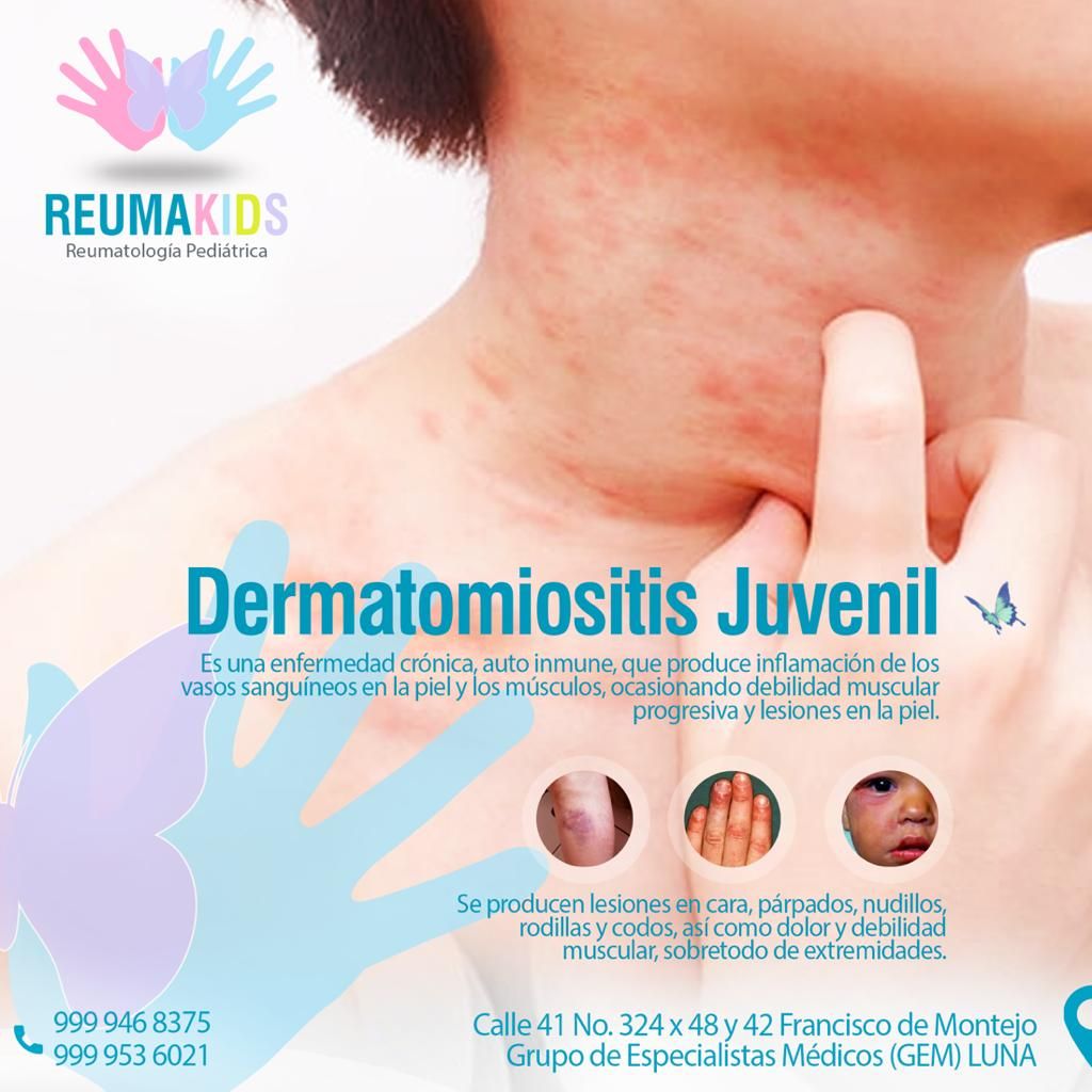 Andrés Noé Rodríguez García-45