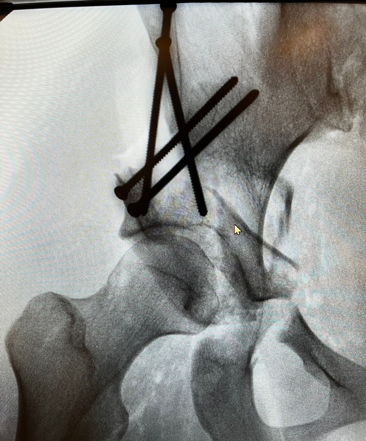 Ozmar Ignacio Ochoa Villar-3