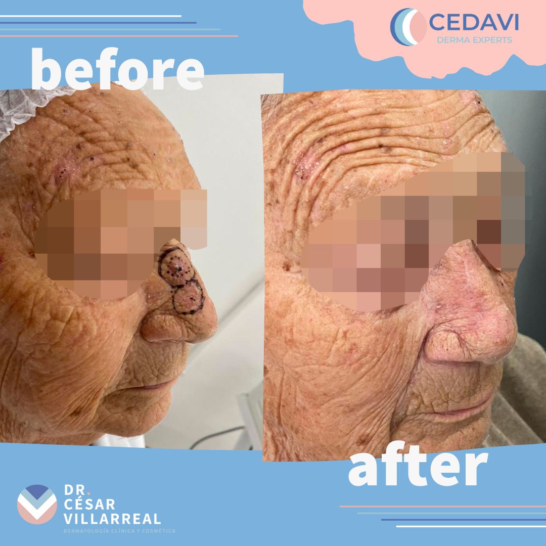 César Daniel Villarreal Villarreal-16