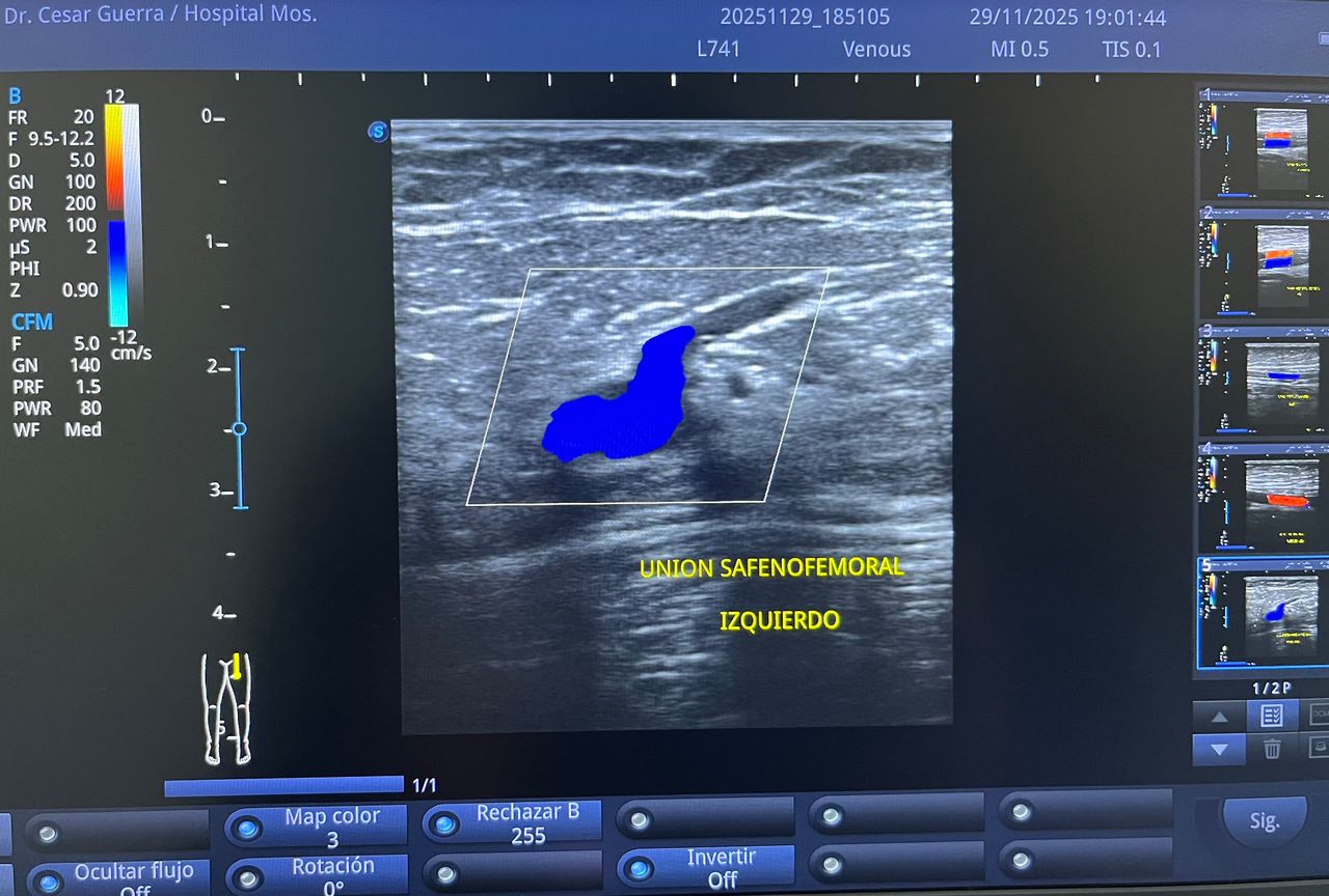 César Guerra Martínez-56