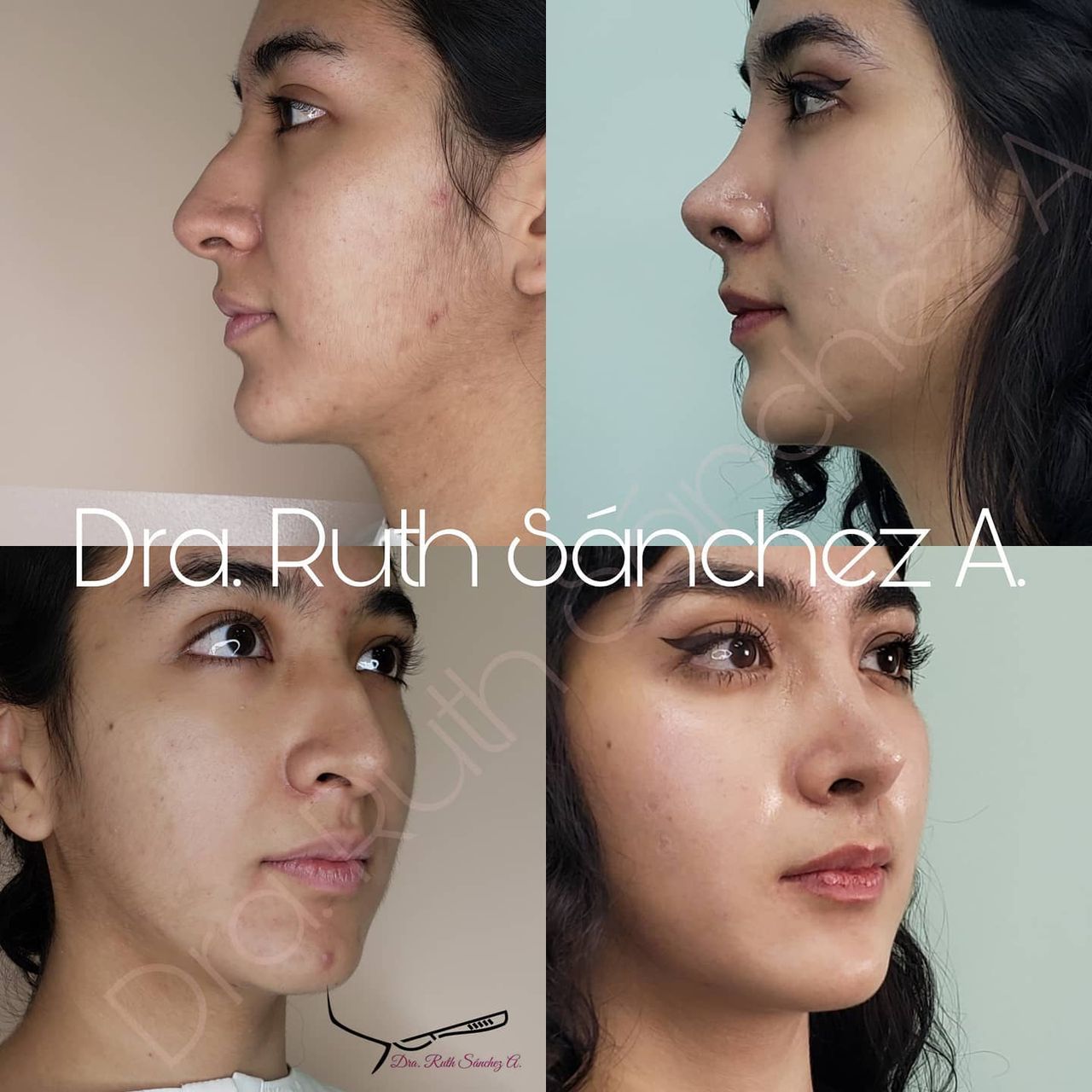 Ruth Sánchez Alvarez-4