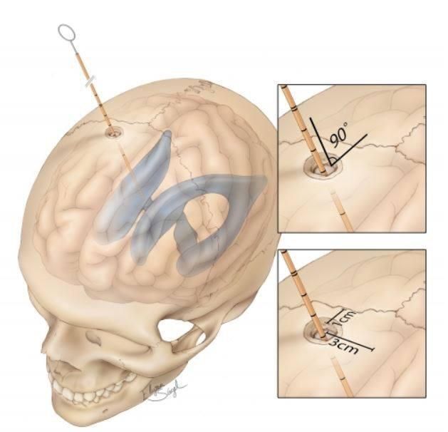 Héctor Francisco Pompa García-16