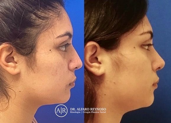 Jose Alberto Alfaro Reynoso-11