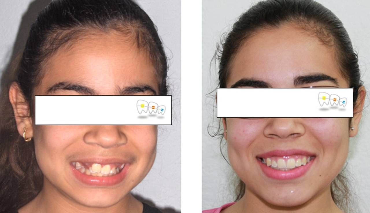 Iris Ocampo Fonseca-5