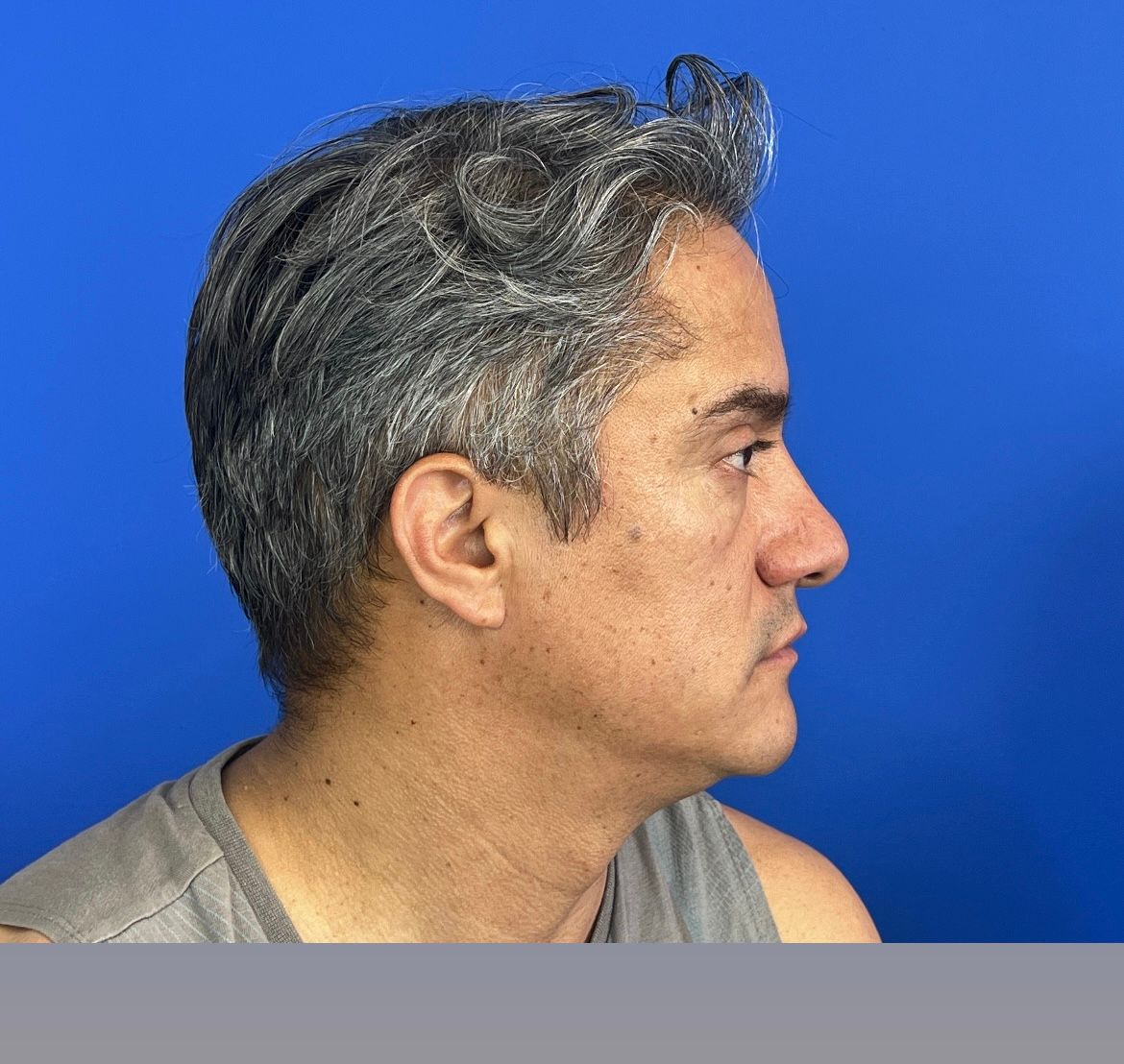 Axel Joffre Mora-6