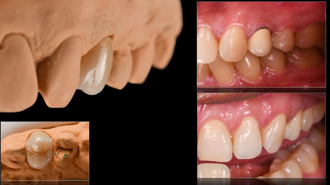 Ricardo López Lemus-64