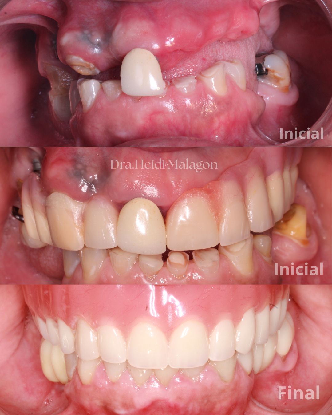 Heidi Mendoza Malagón-2