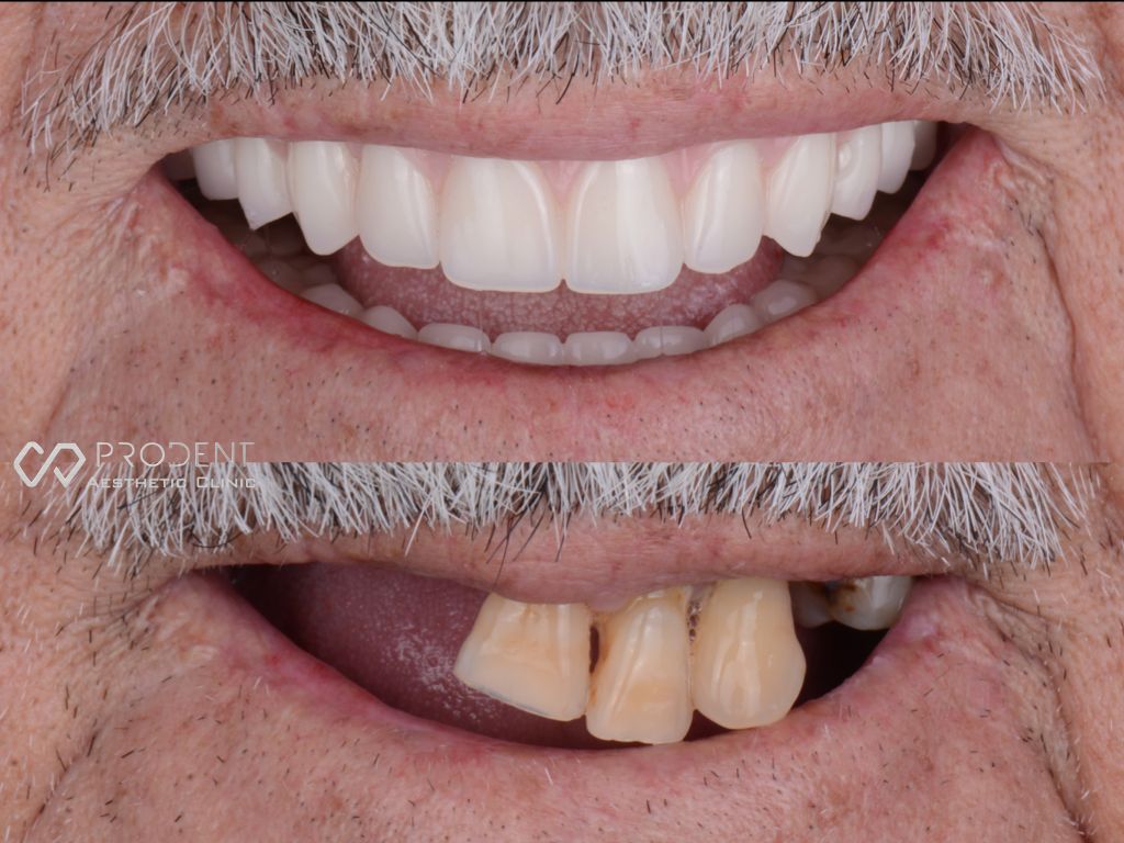 Ramiro Ivan Pérez Murillo-19