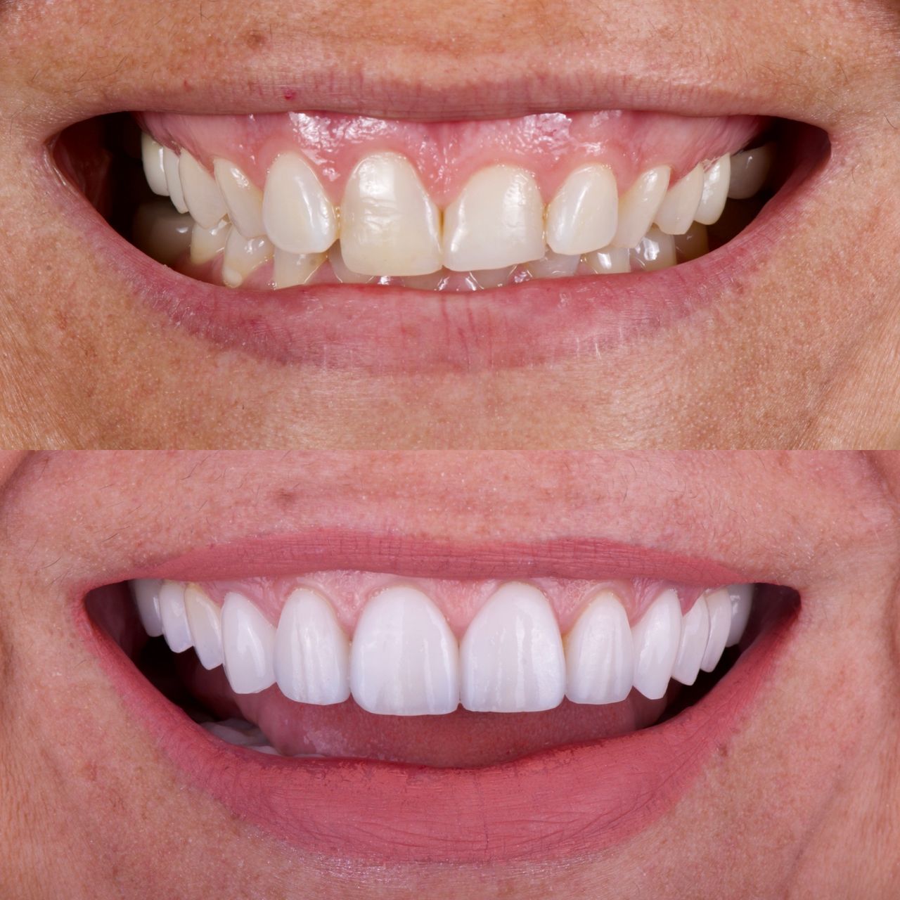 Mauricio Villegas Akena-21