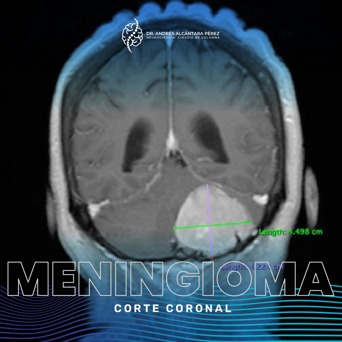 Andres Alcántara Pérez-15