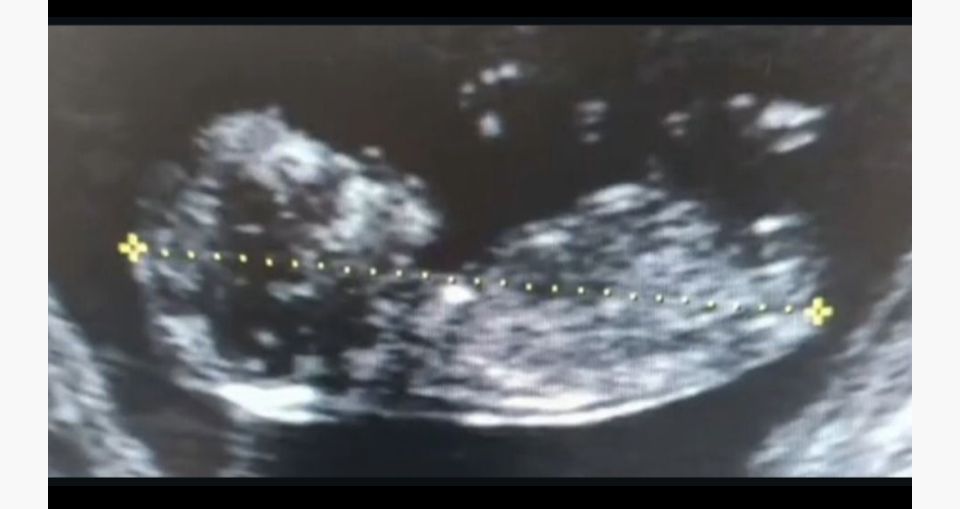 Ana Itzel Gaona Guevara-0