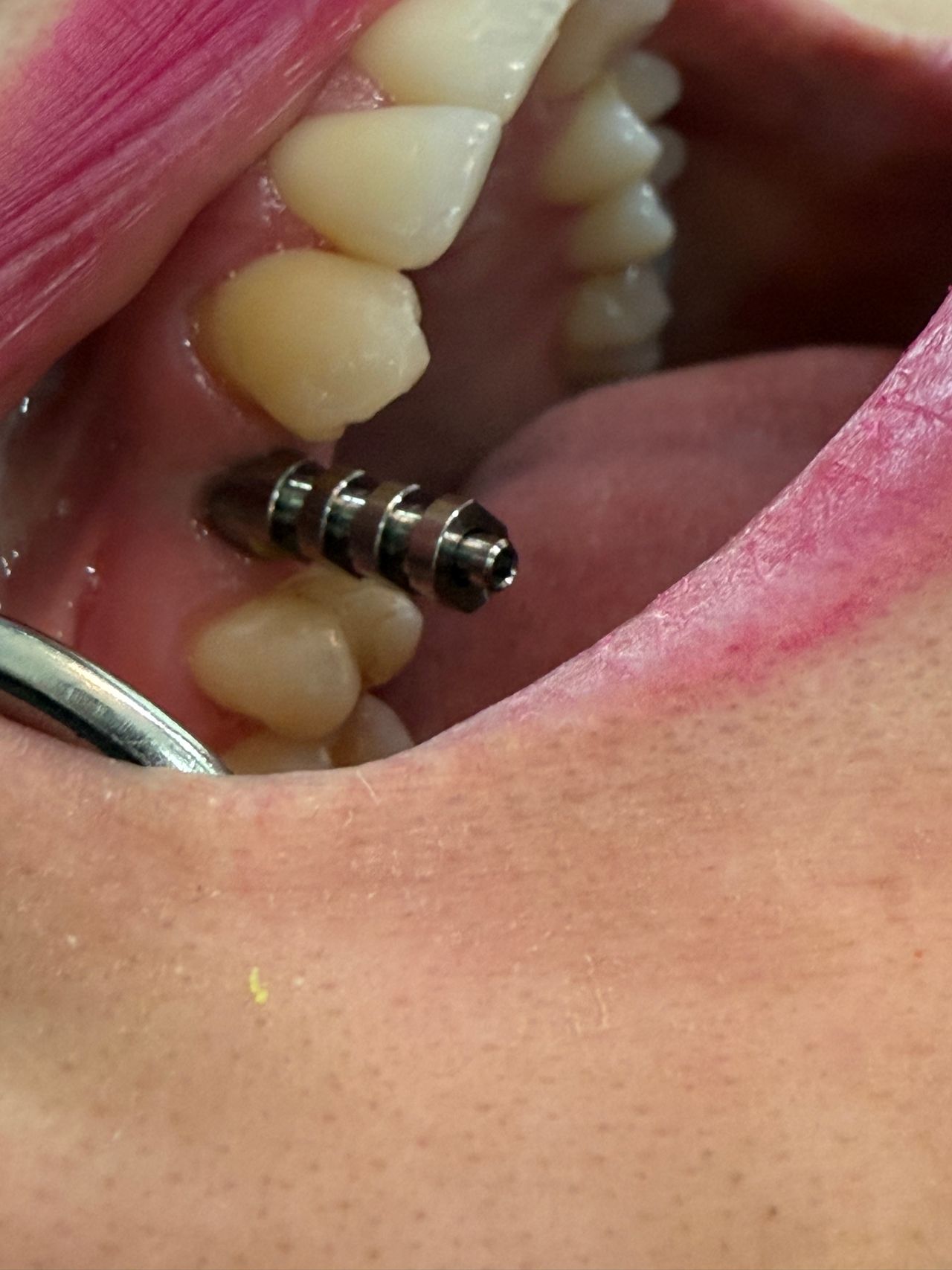 Jair Contreras García-65