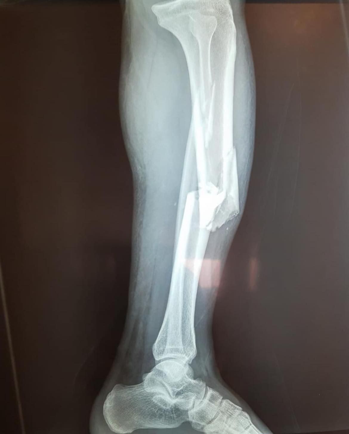 Felix Alfaro Arias-14